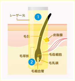 レーザー説明図