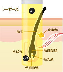 レーザー脱毛のしくみ