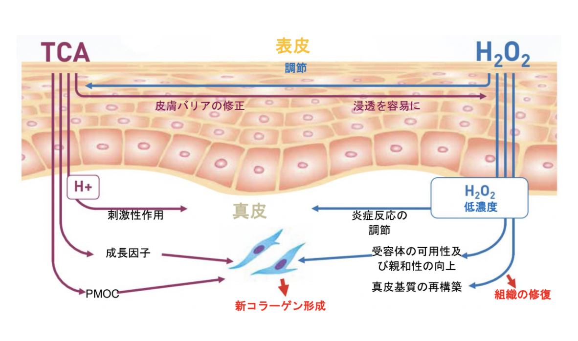 表皮真皮イラスト